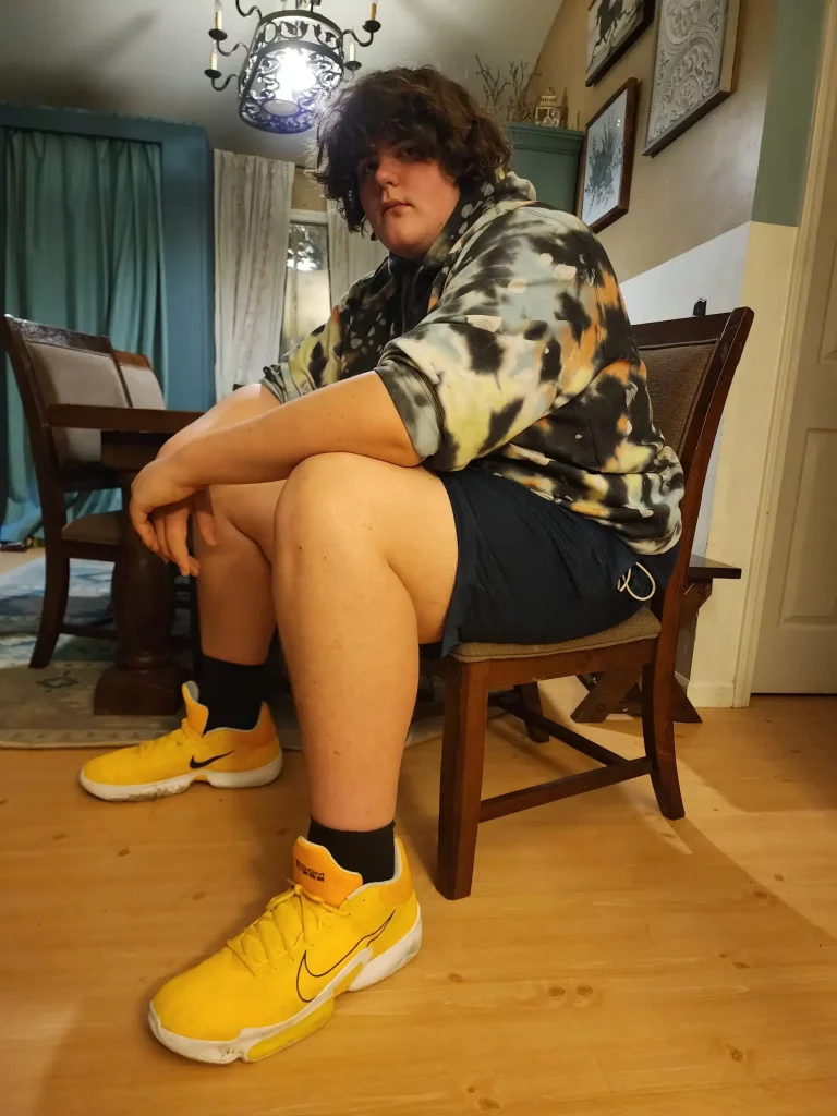 The Giant-Footed Teen: Eric Kilburn's Story